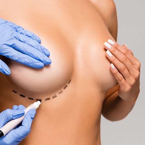 Cirugia de senos Dr Jean Carlos Angulo