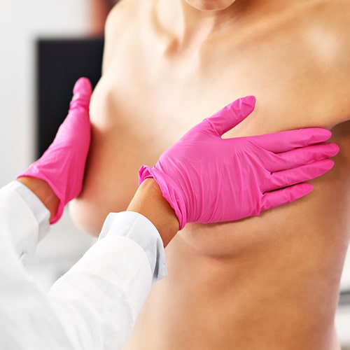 Cirugia de senos Dr Jean Carlos Angulo