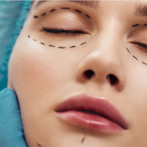 Blefaroplastia Dr Jean carlos Angulo