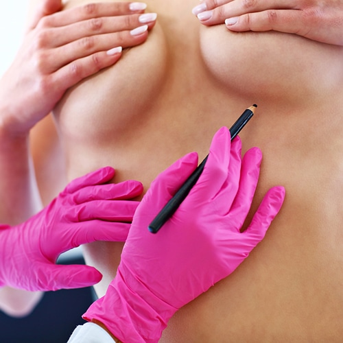 Cirugia de senos Dr Jean Carlos Angulo