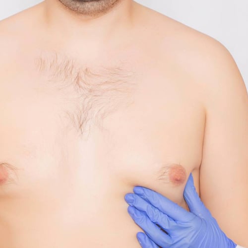 Cirugia de senos Dr Jean Carlos Angulo