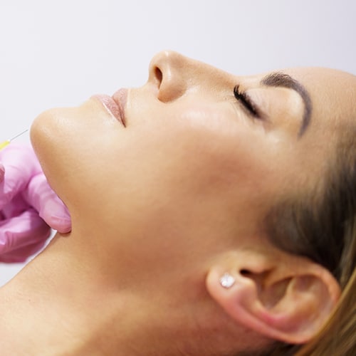 Otoplastia Dr Jean carlos Angulo