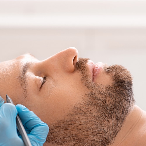 Rinoplastia Dr Jean carlos Angulo